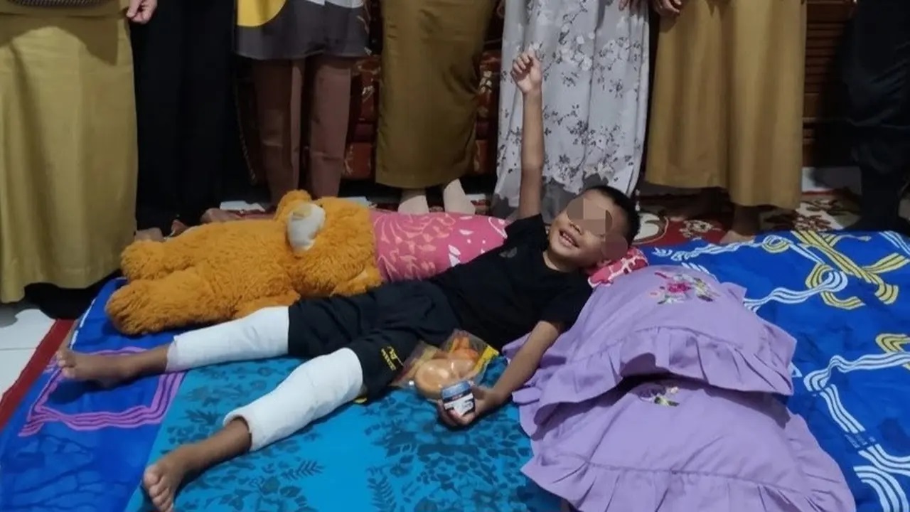 Siswa Kelas 1 SD di Bandar Lampung Diduga Dianiaya Kakak Kelas hingga Alami Patah Tulang